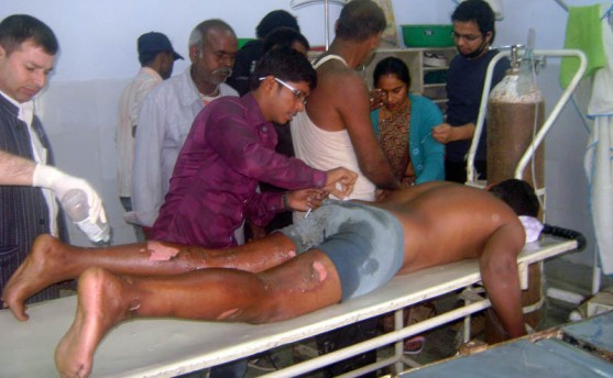 मोर्चाका कार्यकर्ताले युवकको शरीरमा पेट्रोल छर्की आगो लगाए