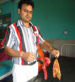 विदेशमा उपचार गराउँदा सास्ती