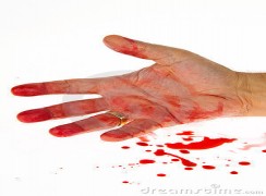 दुई महिनाअघि प्रेमविवाह गरेकी श्रीमतीले छुरा हानिन्