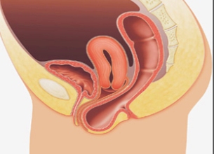 किशोरीअवस्थामै पाठेघर खस्न थाल्यो